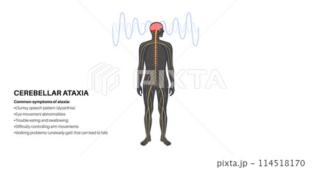 Ataxia cerebellar disorder Ataxia cerebellar disorder 114518170
