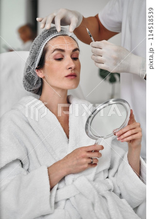 Contour modeling with fillers 114518539