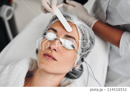 A woman receives IPL therapy in a beauty salon. A woman receives IPL therapy in a beauty salon. 114518552