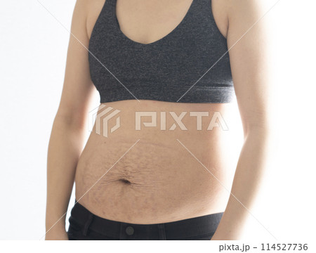 産後の妊娠線が残る女性のお腹のアップ 114527736
