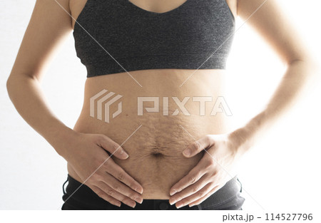 産後の妊娠線が残る女性のお腹のアップ 産後の妊娠線が残る女性のお腹のアップ 114527796