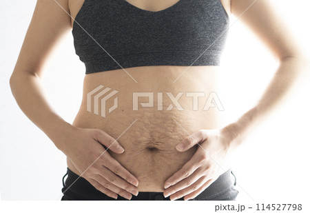 産後の妊娠線が残る女性のお腹のアップ 産後の妊娠線が残る女性のお腹のアップ 114527798