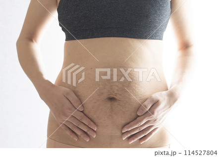 産後の妊娠線が残る女性のお腹のアップ 産後の妊娠線が残る女性のお腹のアップ 114527804