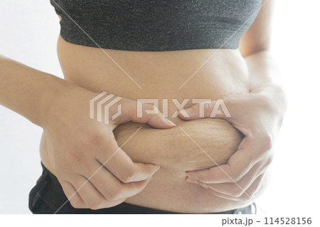 産後の妊娠線が残るお腹の肉をつまむ女性 114528156