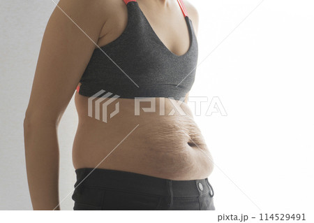 産後の妊娠線が残る猫背の女性のお腹 114529491
