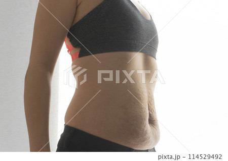 産後の妊娠線が残る反り腰の女性のお腹 114529492
