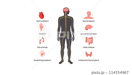 Ataxia cerebellar disorder Ataxia cerebellar disorder 114554967
