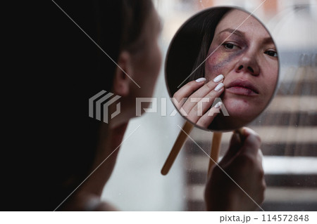Domestic violence, abuse woman with bruise on face by the window looks in the mirror 114572848
