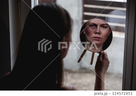 Domestic violence, abuse woman with bruise on face by the window looks in the mirror Domestic violence, abuse woman with bruise on face by the window looks in the mirror 114572851