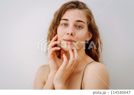 Close-up portrait of a beautiful woman without makeup with imperfect skin. Acne skin. Natural beauty Close-up portrait of a beautiful woman without makeup with imperfect skin. Acne skin. Natural beauty 114580047