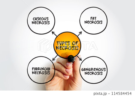 Types of Necrosis (death of body tissue) mind map text concept for presentations and reports 114584454