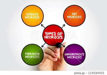 Types of Necrosis (death of body tissue) mind map text concept for presentations and reports 114584455