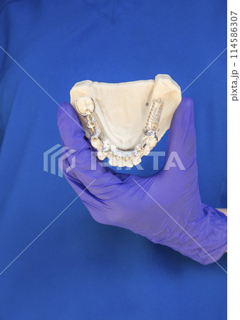 Dentist Holding Metal Frame Lower Partial Denture with Die Stone, Plaster Cast Molds Of Lower Jaws, Cobalt Chrome Dental Plate, 3D Printed Bridge. Vertical Plane Dentist Holding Metal Frame Lower Partial Denture with Die Stone, Plaster Cast Molds Of Lower Jaws, Cobalt Chrome Dental Plate, 3D Printed Bridge. Vertical Plane 114586307