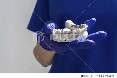 Cropped Doctor with Metal Frame Lower Partial Denture with Die Stone, Plaster Cast Molds Of Lower Jaws in Gloved Hand on White Background, Cobalt Chrome Dental Plate, 3D Printed Bridge. Horizontal 114586309