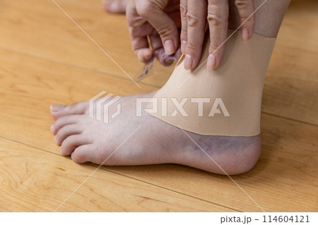 ねん挫した足首に湿布を貼る女性 114604121