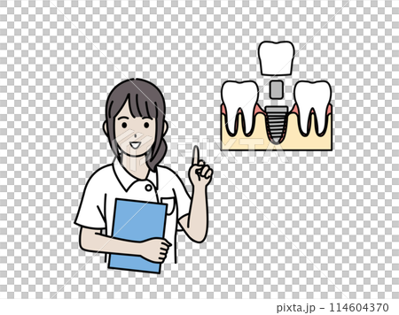 女牙醫和牙齒保健員解釋植體的插圖 114604370