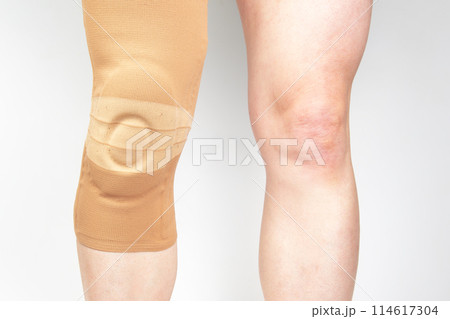 bandage for fixing the injured knee of the human leg on a white background.  114617304