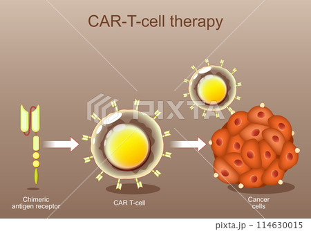 CAR-T cell therapy. cancer immunotherapy. Chimeric antigen receptor CAR-T cell therapy. cancer immunotherapy. Chimeric antigen receptor 114630015