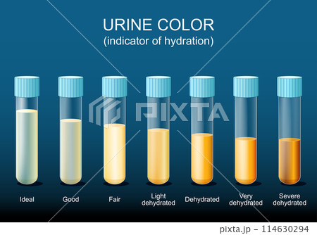 Test tubes with urine Test tubes with urine 114630294