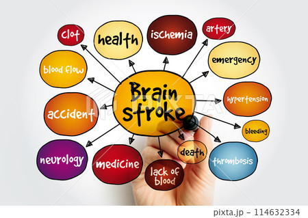 Brain stroke mind map, medical concept for presentations and reports 114632334