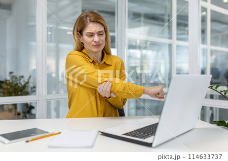 A woman in a yellow shirt experiencing elbow pain while working on her laptop in a modern office environment. A woman in a yellow shirt experiencing elbow pain while working on her laptop in a modern office environment. 114633737