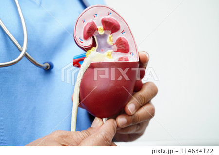 Chronic kidney disease, doctor with model for treatment urinary system, urology, Estimated glomerular filtration rate eGFR. 114634122
