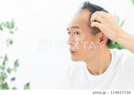 ミドル男性　ヘアケア　生え際 114657236