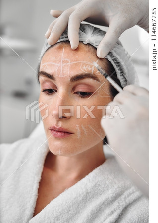 Botulinum therapy. Correction of mimic wrinkles. 114667285
