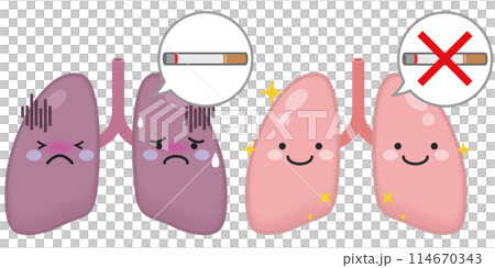 病気にかかった肺と健康な肺のキャラクター 病気にかかった肺と健康な肺のキャラクター 114670343