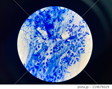 AFB 3+ sample collect sputum. 114676029