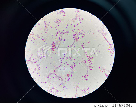Bacteria cell gram neagtive bacilli. Bacteria cell gram neagtive bacilli. 114676046