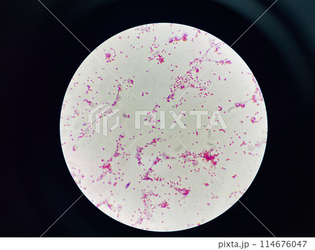Bacteria cell gram neagtive bacilli. Bacteria cell gram neagtive bacilli. 114676047