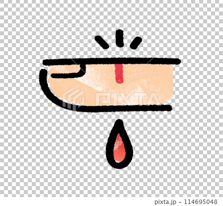 Finger injury 114695048