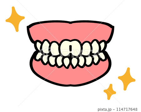審美歯科、白い歯の入れ歯イラスト素材 114717648