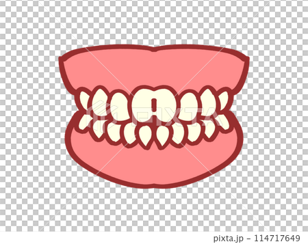 Cosmetic dentistry, white teeth dentures illustration material 114717649