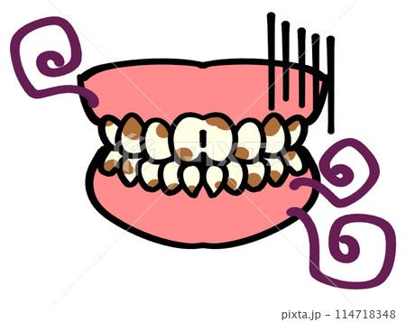 審美歯科、汚れた歯の入れ歯イラスト素材 114718348