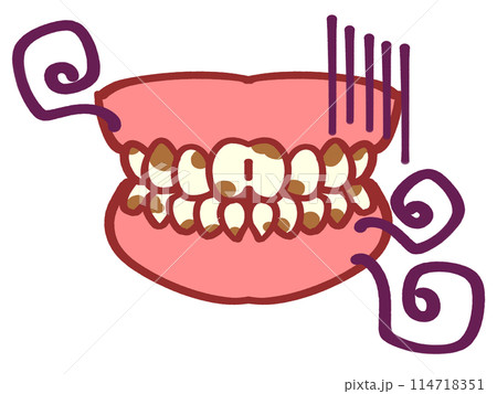 審美歯科、汚れた歯の入れ歯イラスト素材 114718351
