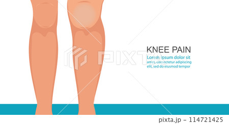 Body people with leg and Knee pain symptoms. 114721425