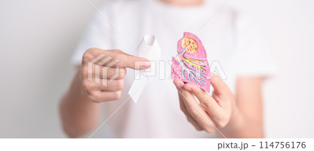 November Lung Cancer Awareness month. Doctor with Smoker Lung anatomy model and White ribbon in hospital. Healthcare and World Cancer day concept 114756176