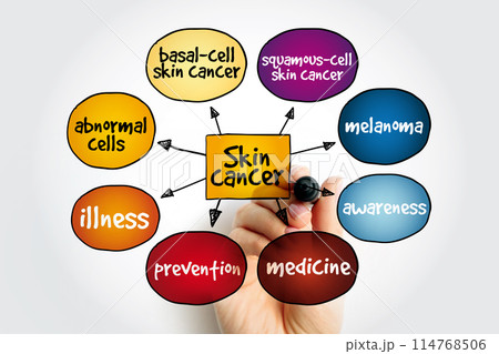 Skin cancer mind map, medical concept for presentations and reports 114768506