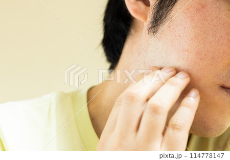 肌を気にする男性 114778147