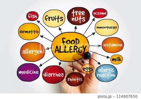 Food allergy mind map, health concept for presentations and reports 114807650
