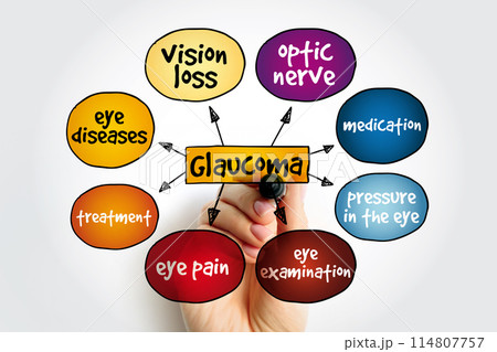 Glaucoma is a group of eye diseases that result in damage to the optic nerve (or retina) and cause vision loss, mind map medical concept background Glaucoma is a group of eye diseases that result in damage to the optic nerve (or retina) and cause vision loss, mind map medical concept background 114807757