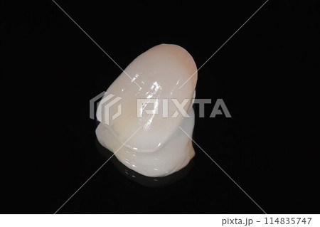 歯医者さんで綺麗なセラミックの歯に直そう 114835747