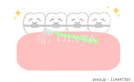 オーラル・デンタルケアのイラスト 歯列矯正 オーラル・デンタルケアのイラスト 歯列矯正 114847303