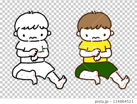 手足に出ている赤い発疹を気にする子供のイラスト 114864521