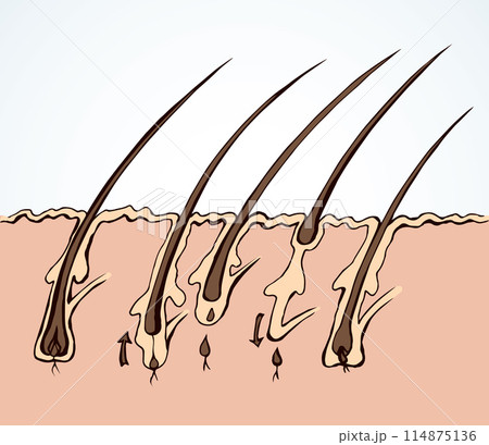 Hair growth draft. Vector drawing 114875136