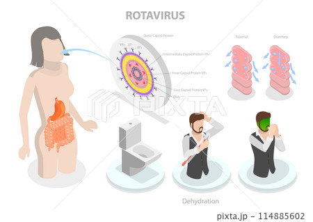 3D Isometric Flat Conceptual Illustration of Rotavirus Infection, Diarrhea, Vomiting and Dehydration 3D Isometric Flat Conceptual Illustration of Rotavirus Infection, Diarrhea, Vomiting and Dehydration 114885602