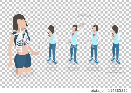 3D Isometric Flat Illustration of Costochondritis, Chest Pain in the Upper and Middle Rib Cage 3D Isometric Flat Illustration of Costochondritis, Chest Pain in the Upper and Middle Rib Cage 114885852