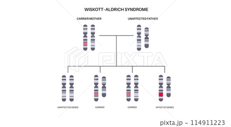 Wiskott Aldrich syndrome 114911223